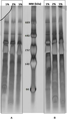 Membrane Proteocomplexome of Campylobacter jejuni Using 2-D Blue Native/SDS-PAGE Combined to Bioinformatics Analysis